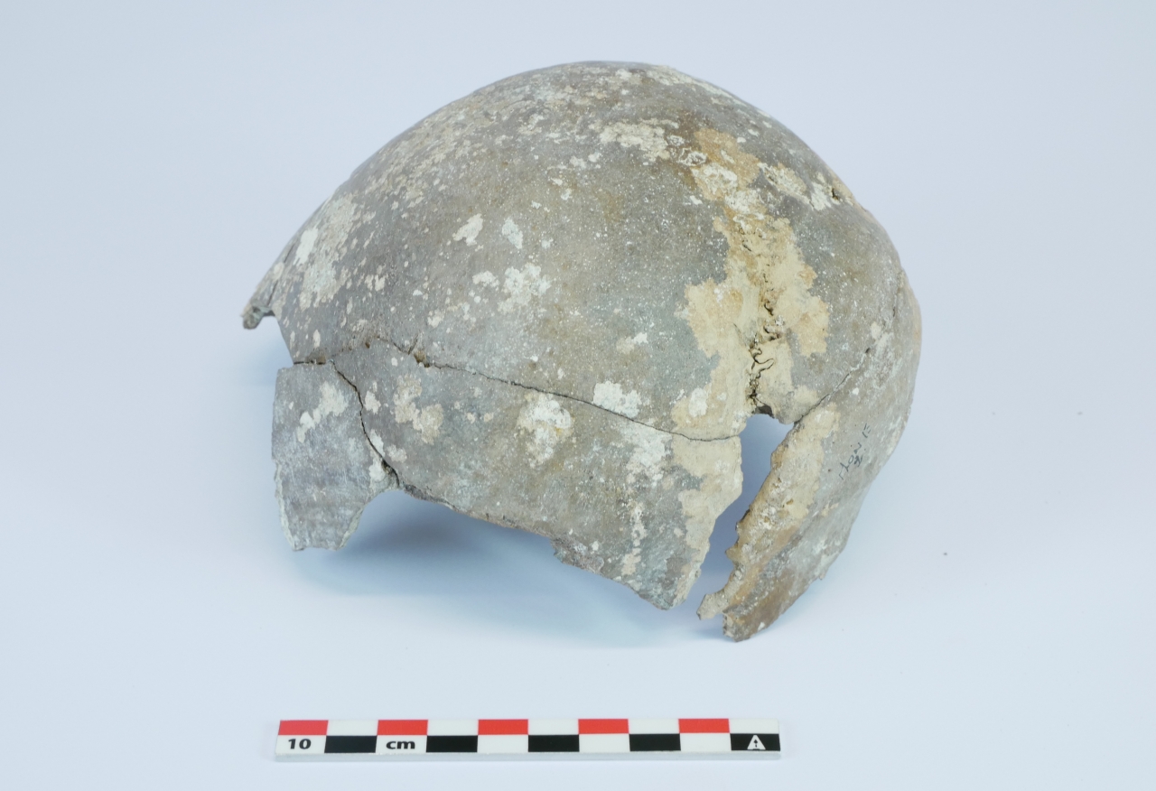 fragment van bovenkant van een schedel